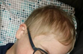 The Down Syndrome Holocaust